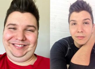 Nikocado's weight loss Journey